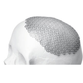 Schädelimplantat - BioMesh®  - Bioplate