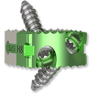 HWS-Zwischenwirbelimplantat - TITANOPEEK - Osimplant - ventraler Zugang / Titan / aus PEEK