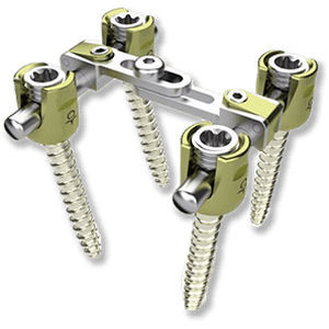Thorako-lumbales Stabilisierungssystem für Osteosynthese - ON PLUS - Osimplant - dorsaler Zugang / für Erwachsene