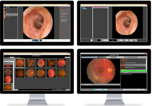 Ausbildungssoftware - Educators Toolkit™ - OtoSim Inc. - für Krankenhaus / für Ophthalmoskopie / für Otoskopie