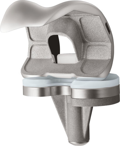 Femur-Patella Knieprothese - U2™  - US Orthopedics - mit fester Scheibe