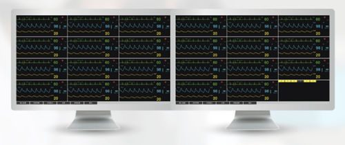 Patientenüberwachungsstation - WCMS-88 - Wisonic - 64 Betten