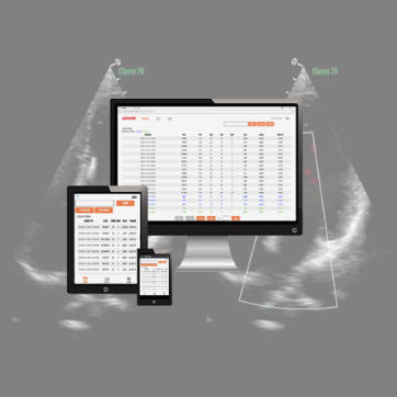 Aufzeichnungssoftware - wiCloud - Wisonic - medizinisch / für Ultraschalluntersuchungen / Windows