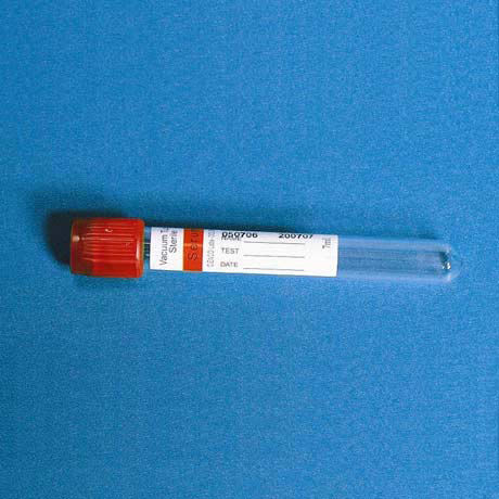 ESR-Probenahmeröhrchen - TK-91xx series - TENKO MEDICAL SYSTEM CORP - zylinderförmig / Blut / für Probennahme