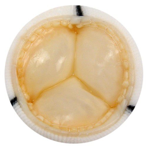 Biologischer Aortenklappenersatz / Pulmonal - 8431 - Braile Biomedica - Trikuspidal / Aorta / Mitral