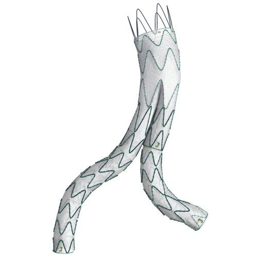 Stentgraft / Aorta abdominalis - LINUS® - Braile Biomedica - Nitinol