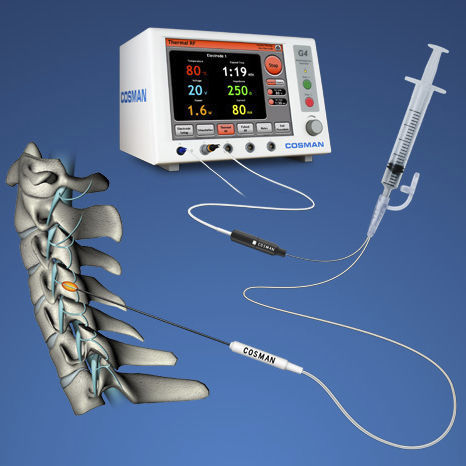 Elektrochirurgische Elektrode - CU - Cosman Medical - Nadel / wiederverwendbar / zum Einmalgebrauch