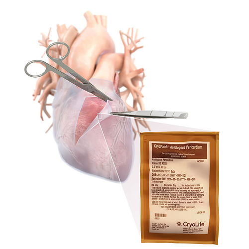 Herzchirurgie-Matrix - CryoPatch - Cryolife - allograft