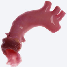 Aorta vaskuläre Bioprothese - CryoValve® - Cryolife - allograft / mit Ventil