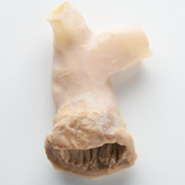 Vaskuläre Bioprothese / Lungenarterie - CryoValve® SG - Cryolife - allograft / mit Ventil