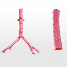 Vaskuläre Bioprothese / Arteria iliaca - CryoArtery® - Cryolife - allograft / gegabelt