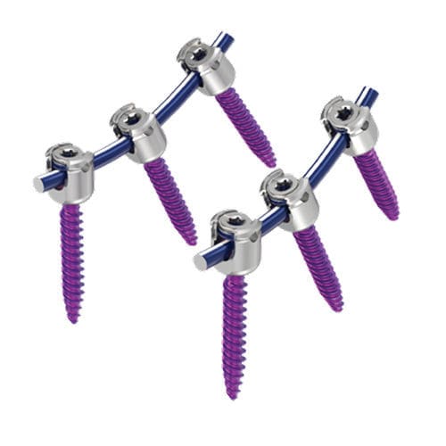 Thorako-lumbales Stabilisierungssystem für Osteosynthese - MAS® - NuVasive - dorsaler Zugang / für Erwachsene