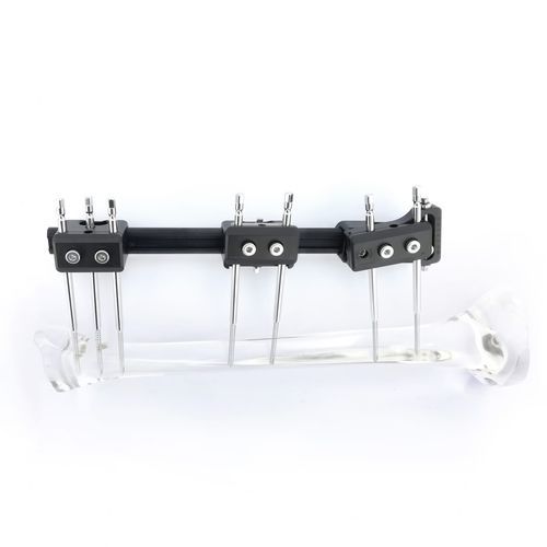 Fixateur externe / für Tibia - FIXUS88 mini - Fixus - für Oberschenkelknochen / für Radius / für Humerus