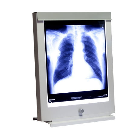 Röntgenfilmbetrachter / 1 Betrachtungsfläche - Rego X-ray - 2 Betrachtungsflächen / 3 Betrachtungsflächen / 4 Betrachtungsfeldern