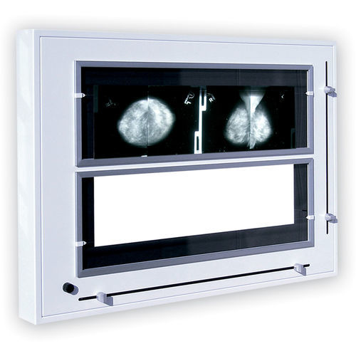 Röntgenfilmbetrachter / 2 Betrachtungsflächen - Rego X-ray - Weißlicht / für Mammographie