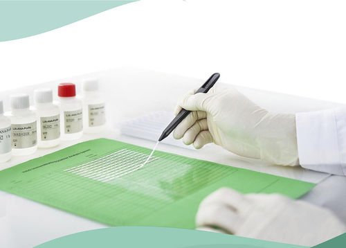 Autoimmunerkrankungen-Teststreifen - Shenzhen Yhlo Biotech Co., Ltd. - Lebererkrankungen / für Diabetes / Durchblutung