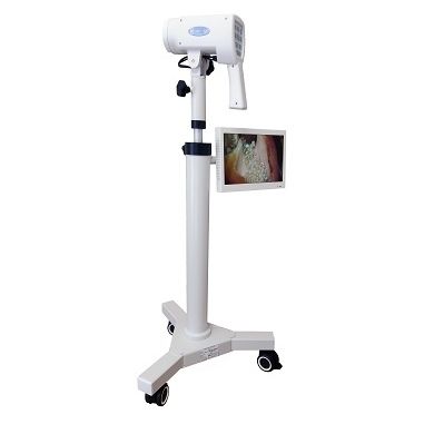 Videokolposkop - SLV - 101 HDM - Biomedicinos Technika - auf Wagen