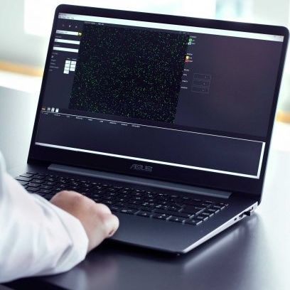 Medizinische Software - NC-View™ - Chemometec - Bildanalyse / Reporting / Visualisierung
