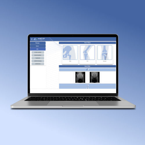 Management-Software - mediCAD Hectec GmbH - Planung / Präoperative Planung / Orthopädie