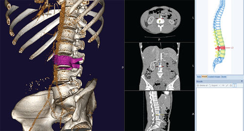 Orthopädie-Software - mediCAD Hectec GmbH