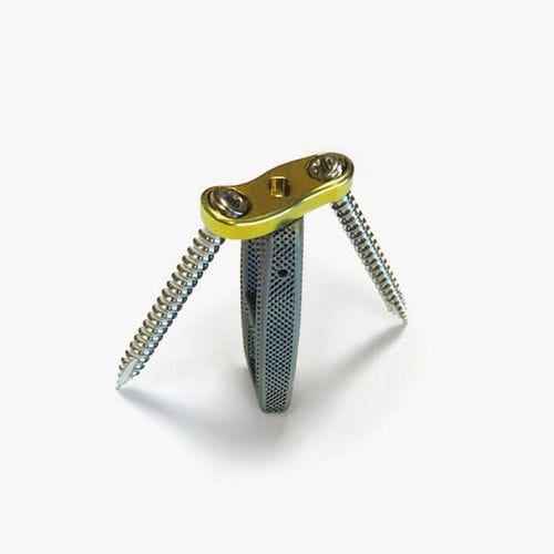 LWS-Zwischenwirbelimplantat - Idys®-LLIF 3DTi - Clariance - lateraler Zugang / Titan / mit Lendenwirbel-Knochenplatte