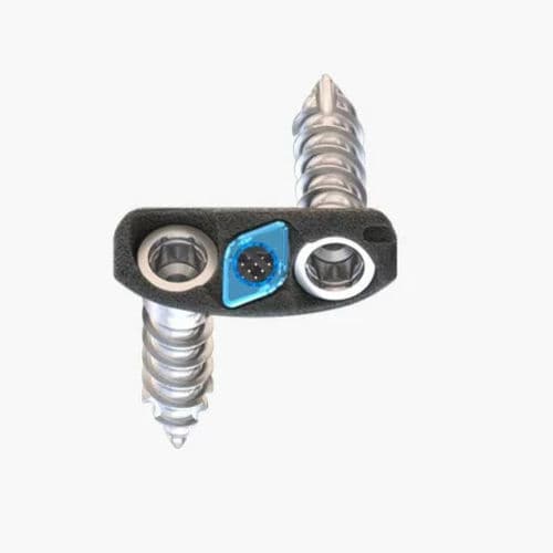 HWS-Zwischenwirbelimplantat - Idys®-C ZP 3DTi - Clariance - ventraler Zugang / Titan
