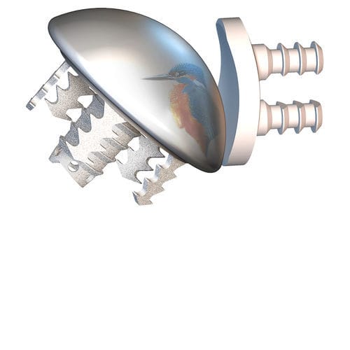 Zementfreie Humeruskopfprothese - EASYTECH® - FX Solutions