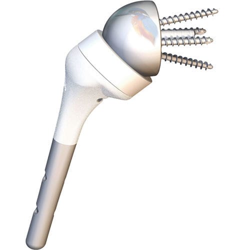 Inverse Schulterprothese - HUMELOCK ® - FX Solutions - zementfrei