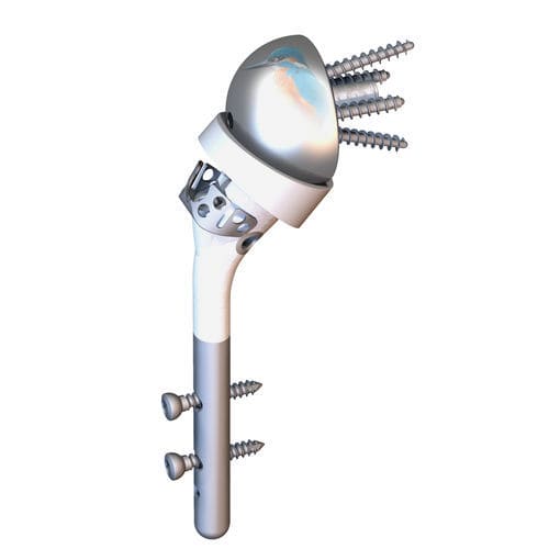 Inverser Humerusschaft - HUMELOCK II® - FX Solutions - zementfrei