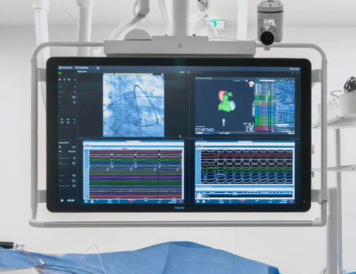 Medizinische Software - ORIS - Ditec Medical - Visualisierung / 4K