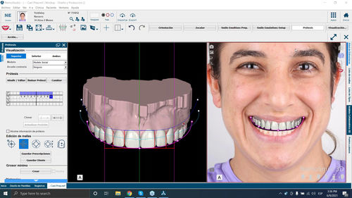 Software für digitales Lächelndesign - NemoSmile - Nemotec - zur Bildverbesserung / Bildanalyse / für Patientendatenverwaltung