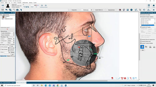 Diagnose-Software - Nemotec