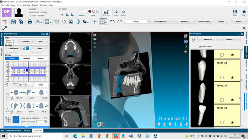 Software / Präoperative Planung - NemoFab Ortho - Nemotec - medizinisch / für Kliniken / Dental