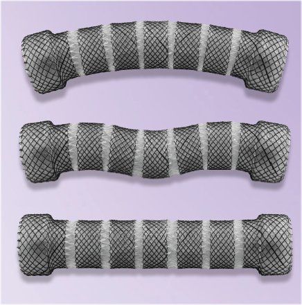 Speiseröhren-Stent - ESO-4-20-60-SEG - Creo Medical - Silikon / Nitinol / selbstexpandierend