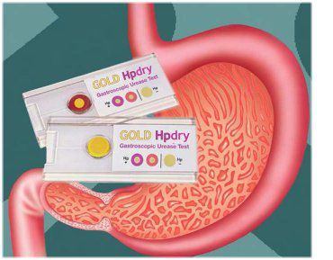 Testkit für Infektionskrankheiten - Gold hpdry - Creo Medical - Urease / Helicobacter pylori / für biologische Proben