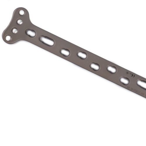 Osteotomieplatte für Radius - 122261008 - Canwell Medical - distal / mit Verriegelung / Titan