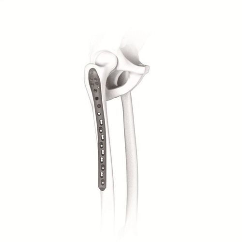 Kompressionsplatte für Oberschenkelknochen - 123228 series - Canwell Medical - proximal / mit Verriegelung / Titan