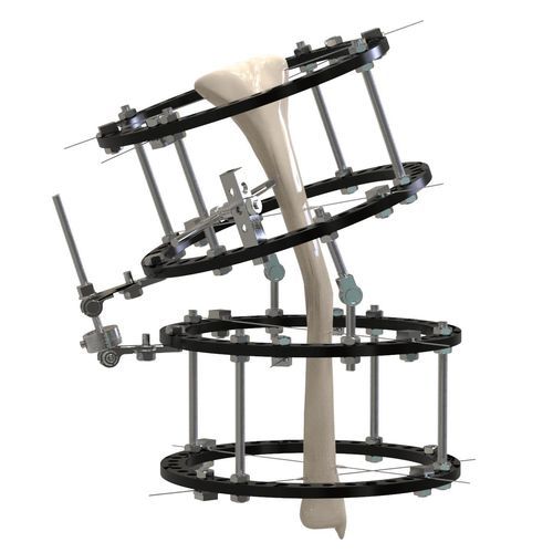 Fixateur externe / für Tibia - 11611 series - Canwell Medical - hybrid / für Erwachsene