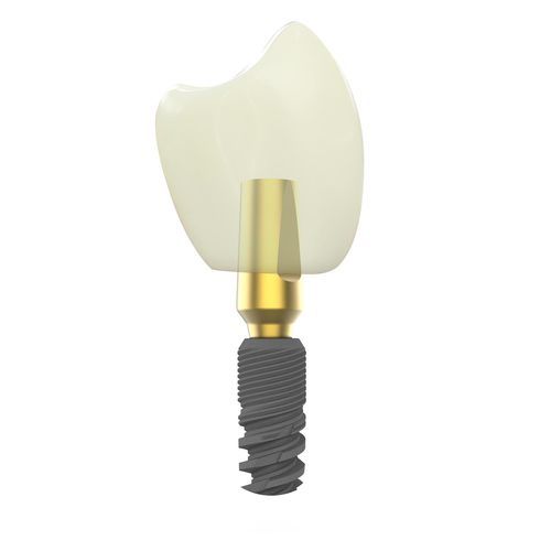 Konisches Zahnimplantat - Canwell Medical - Titan / gerade