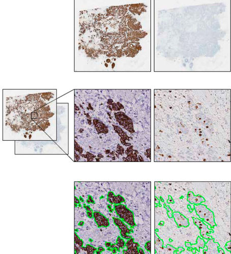 Software-Modul / Bildanalyse - VirtualDoubleStaining™  - Visiopharm - Diagnose / Interpretation / für Kliniken