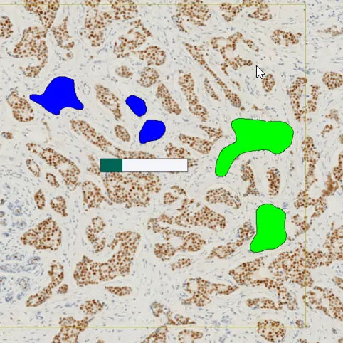 Software-Modul / Onkologie - ONCOTOPIX®  - Visiopharm - Visualisierung / Diagnose / Immunohistochimie