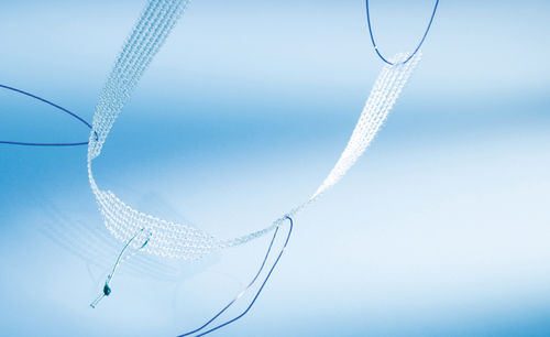 Rekonstuktionseinlage für Harninkontinenz - sensiTVT - AMI - Agency for Medical Innovations - transvaginal / für Frauen