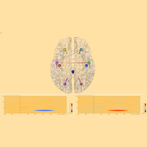 EEG-Software - Connectivity 2.0 - BESA GmbH - Analyse / Visualisierung