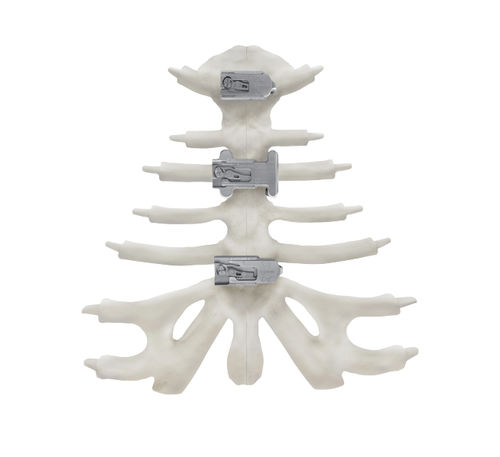 Kompressionsplatte für Brustbein - KontourTalon ® - Kontour Medical Technology - Titan