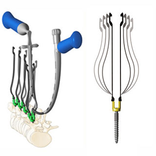 Minimalinvasives Pedikelschrauben-Positionierungssystem - Zina™ - Shanghai Sanyou Medical