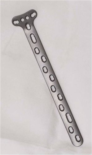 Kompressionsplatte für Radius - 3.5T - Shanghai Sanyou Medical - distal / mit Verriegelung