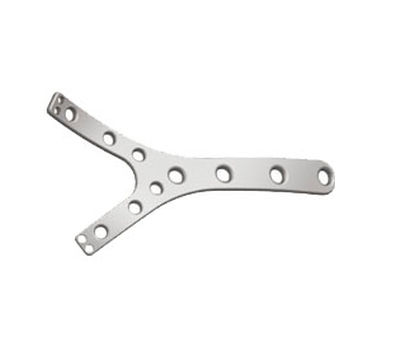 Kompressionsplatte für Humerus - Shanghai Sanyou Medical - distal / mit Verriegelung