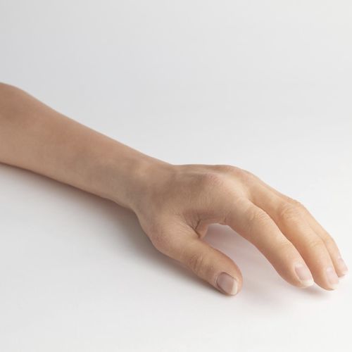 Kosmetische Unterarmprothese - schubert and braun prothesenwerk - für Erwachsene