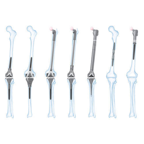 Femur-Patella Knieprothese - MEGASYSTEM-C - Waldemar Link - Revision / mit mobiler Scheibe