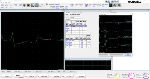Analysesoftware - Sierra Software - Cadwell Industries - Steuerung / Beschaffung / Test
